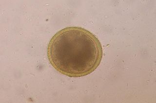 This is a microscopic image of a roundworm egg.