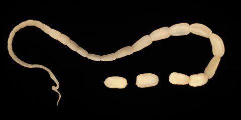 Adult Tapeworm Showing individual segments