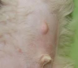 Umbilical Hernia Umbilical Hernia